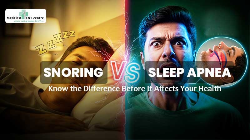 Snoring vs Sleep Apnea Treatment